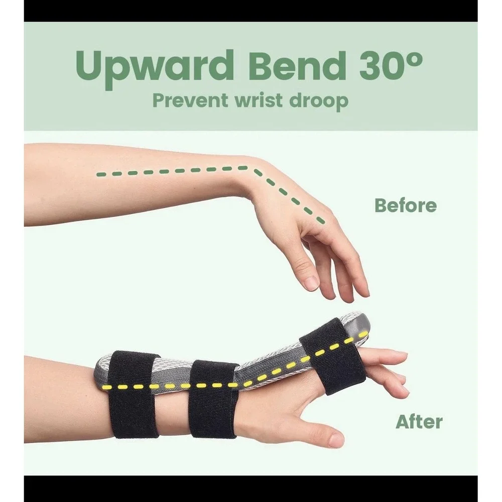 DrFinger Radial Nerve Palsy Splint for Wrist Drop, Adjustable Static Fingers ...